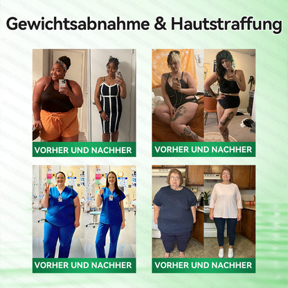 🇦🇹𝐎𝐟𝐟𝐢𝐳𝐢𝐞𝐥𝐥𝐞𝐫 𝐒𝐡𝐨𝐩 |🌱✨𝑮𝑳𝑶𝐑𝐄𝐍𝐃𝘼®𝙈𝙤𝙧𝙞𝙣𝗴𝗮 · 𝗕𝗲𝗿𝗯𝗲𝗿𝒊𝒏 × 𝑵𝘼𝘿+ 10-𝙞𝙣-𝟏 𝐀𝐝𝐯𝐚𝗻𝗰𝗲𝗱 𝗡𝗮𝙣𝙤 𝙈𝙞𝙠𝙧𝐨𝐧𝐚𝐝𝐞𝐥-𝐏𝐚𝒕𝒄𝗵(𝐍𝐮𝐫 𝐞𝐢𝐧𝐦𝐚𝐥 𝐭ä𝐠𝐥𝐢𝐜𝐡, 𝐬𝐢𝐜𝐡𝐭𝐛𝐚𝐫𝐞 𝐕𝐞𝐫ä𝐧𝐝𝐞𝐫𝐮𝐧𝐠𝐞𝐧 𝐢𝐧 𝟕 𝐓𝐚𝐠𝐞𝐧)✅ 𝐅ü𝐫 𝐅𝐞𝐭𝐭𝐥𝐞𝐢𝐛𝐢𝐠𝐤𝐞𝐢𝐭, 𝐇𝐚𝐮𝐭𝐬𝐭𝐫𝐚𝐟𝐟𝐮𝐧𝐠, 𝐃𝐢𝐚𝐛𝐞𝐭𝐞𝐬, 𝐒𝐜𝐡𝐥𝐚𝐟𝐚𝐩𝐧𝐨𝐞, 𝐆𝐞𝐥𝐞𝐧𝐤𝐩𝐫𝐨𝐛𝐥𝐞𝐦𝐞 𝐮𝐧𝐝 𝐦𝐞𝐡𝐫!